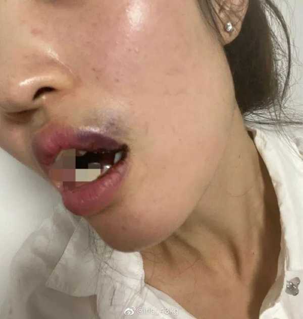 吴秀波最近如何?吴秀波儿子疑家暴女友