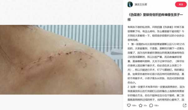 胡歌被曝拍伪装者时砸断女主锁骨