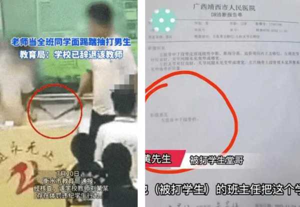 被打破头骨女孩:老师故意打我