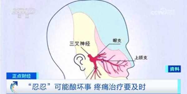 中国疼痛患者有多少人?3亿人遭受慢性疼痛