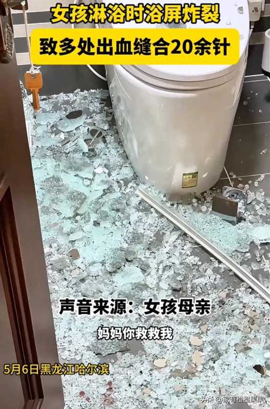 女生洗澡时浴屏爆裂缝合20多针