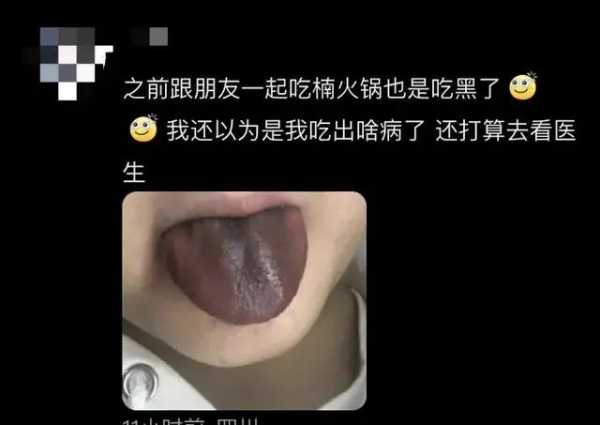 母女吃火锅舌头变黑 门店已关闭