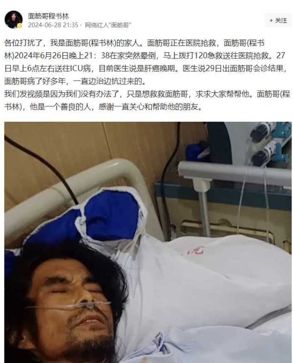 网红面筋哥肝癌晚期进ICU