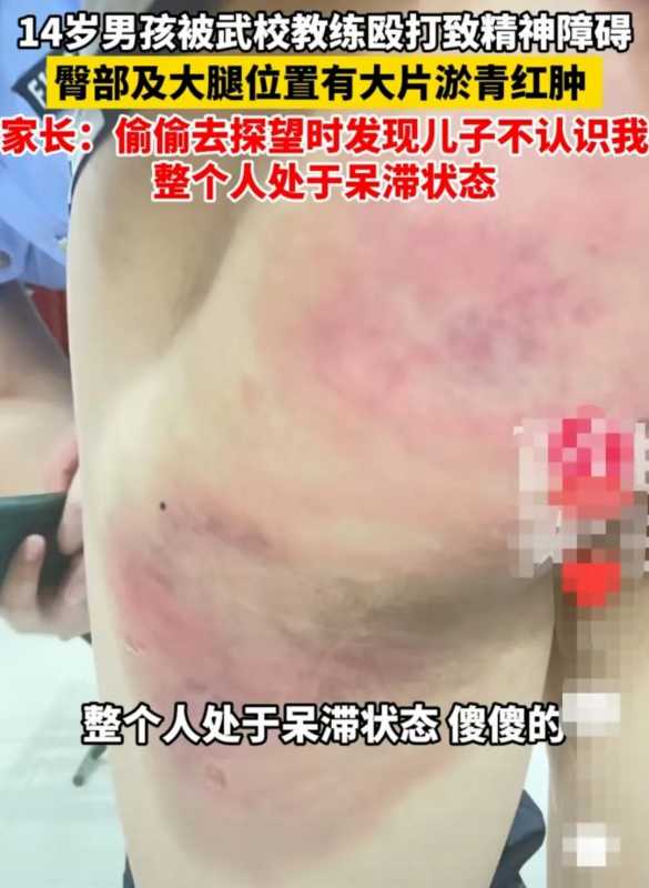 家长去武校看儿子发现其正被教练抽