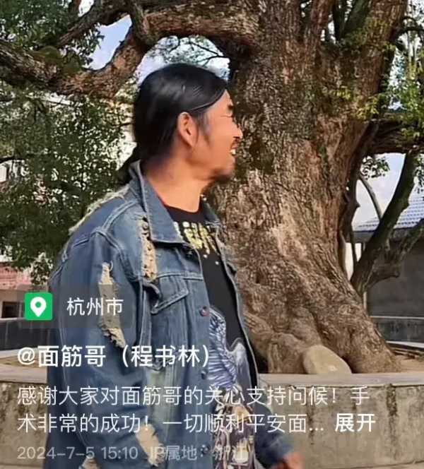 面筋哥现在的现状!手术成功已经苏醒